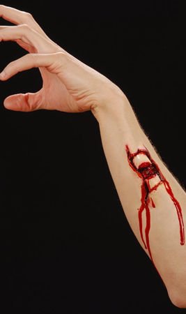Fracture Ouverte Latex