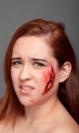 Blessure Éraflure Latex